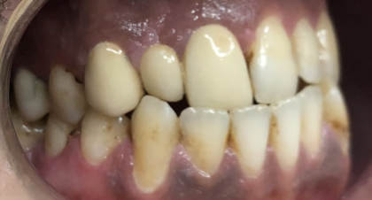 Vorher-Nachher-Bild | Brücken von  Ahmad Saleh | Düsseldorf c0c7c76d Vorher-Bild