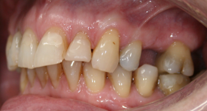 Vorher-Nachher-Bild | Brücken von  Ahmad Saleh | Düsseldorf c0c7c76d Vorher-Bild