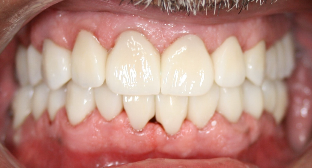 Behandlung Vorher-Nachher-Bild | Kieferorthopädie von  Ahmad Saleh | Düsseldorf c0c7c76d Vorher-Bild